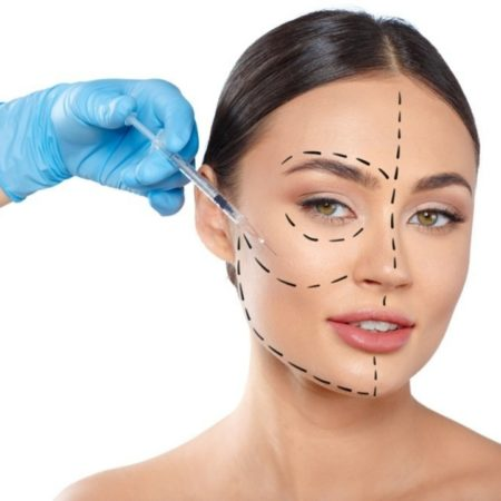 Perfil facial equilibrado após harmonização orofacial